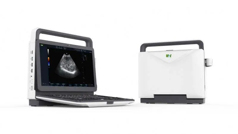 Human High Resolution Medical 4D 5D Color Doppler Portable 5D Ultrasound Machine — image 4