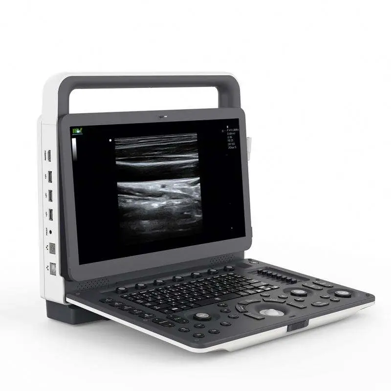 Human High Resolution Medical 4D 5D Color Doppler Portable 5D Ultrasound Machine — image 5