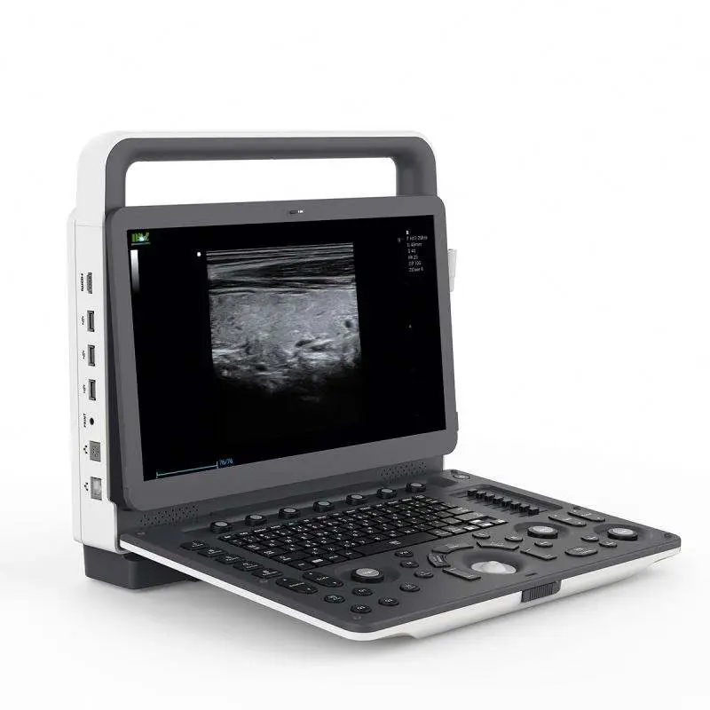 Human High Resolution Medical 4D 5D Color Doppler Portable 5D Ultrasound Machine — image 6