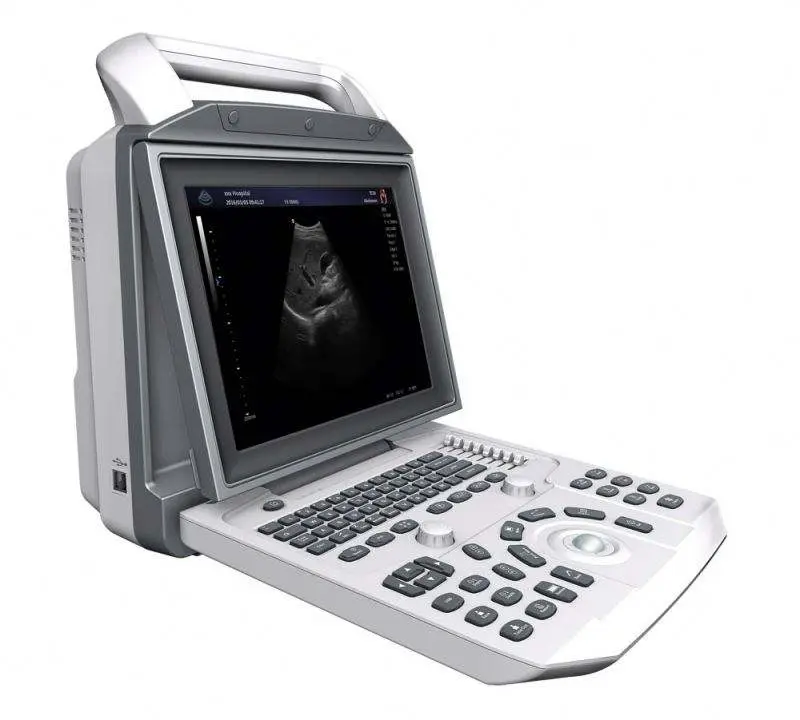 Best Price Human Medical Portable Diagnostic Digital Black and White Ultrasound Machine — view 1