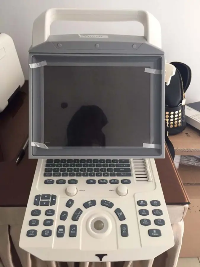 Best Price Human Medical Portable Diagnostic Digital Black and White Ultrasound Machine — view 2