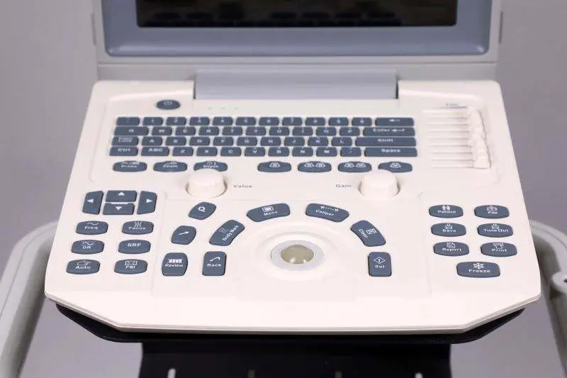 Best Price Human Medical Portable Diagnostic Digital Black and White Ultrasound Machine — view 4