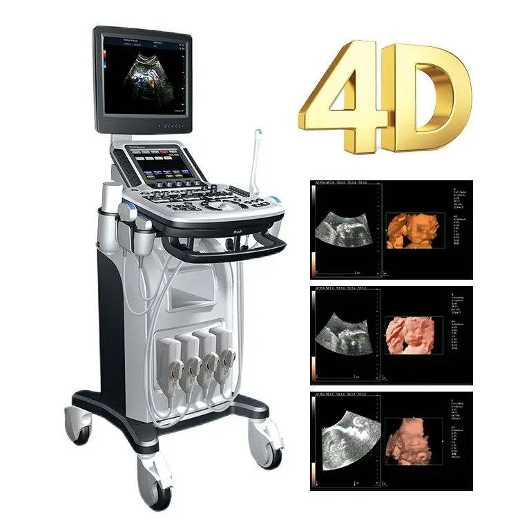 Zoncare Hot Selling Trolley Medical Color Doppler 3D 4D Ultrasound Machine for Hospital — image 3