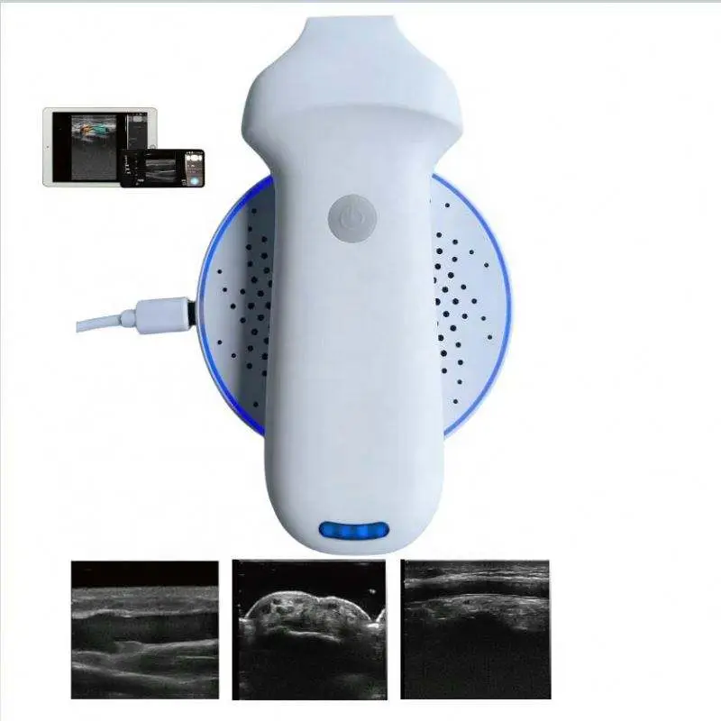 New Arrival Wireless Ultrasound Probe/ 20MHZ Linear Wireless Ultrasound Diagnostic Ultrasound Handheld — image 2
