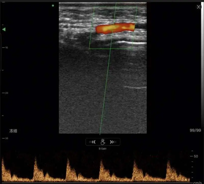 New Arrival Wireless Ultrasound Probe/ 20MHZ Linear Wireless Ultrasound Diagnostic Ultrasound Handheld — image 4