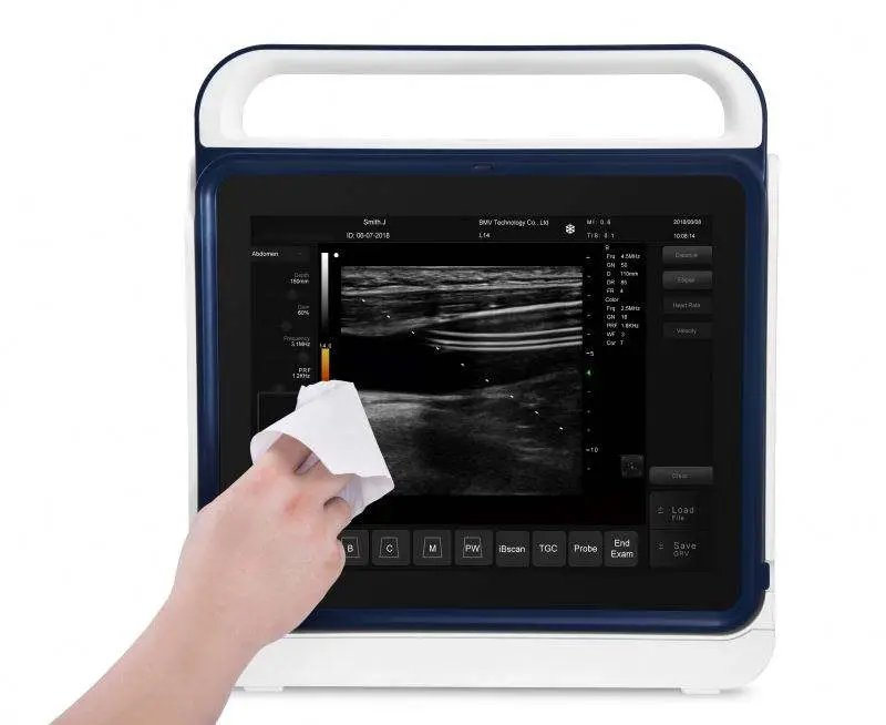 Portable Vet Ultrasound Machine Veterinary Ultrasound Ovum Pick-Up Egg Collection Ultrasound Scanner — image 4