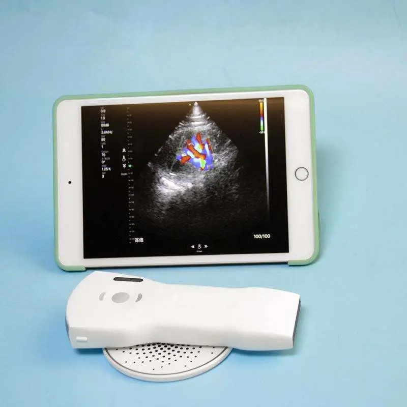 MSL Wireless Ultrasound USB Liner&Convex Probe 192 Element Pocket Color Ultrasound Scanner — image 5