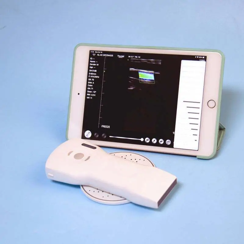MSL Wireless Ultrasound USB Liner&Convex Probe 192 Element Pocket Color Ultrasound Scanner — image 6