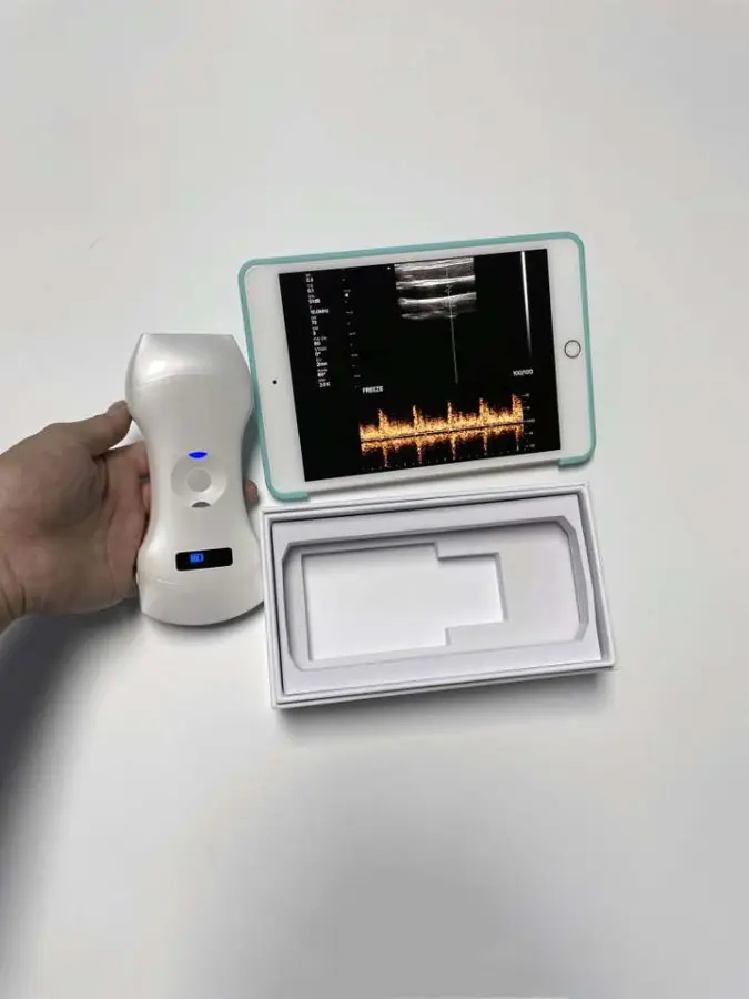 3 in 1 Color Doppler Ultrasound Scanner 192 Elements Phased Array Cardiac, Linear & Convex Probe With Free Handbag — image 6