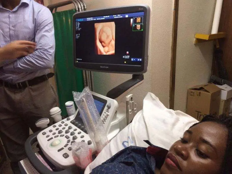 Portable Ultrasound Scanner Trolley Sonoscape S22 Ultrasound Machine — image 2