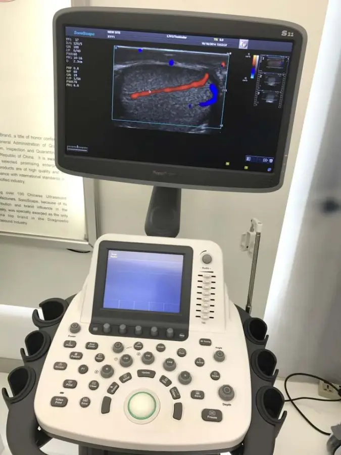 Portable Ultrasound Scanner Trolley Sonoscape S22 Ultrasound Machine — image 3