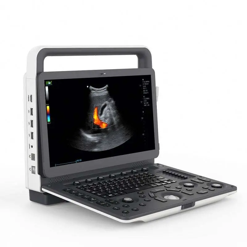 Medical Ultrasonido Diagnostic System 4D Color Doppler Ultrasound Machine with Three Probe Interface — view 1