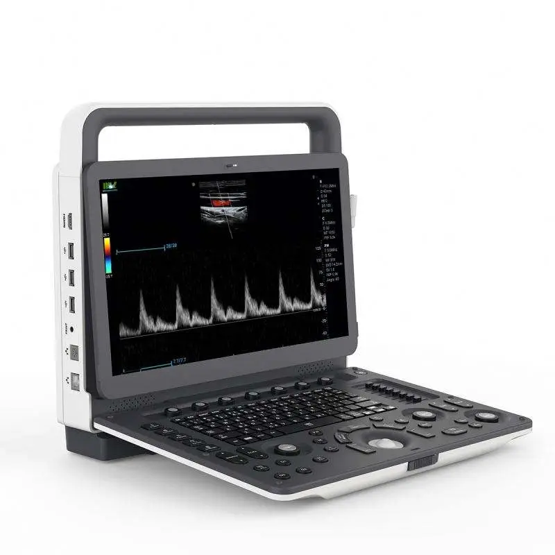 Medical Ultrasonido Diagnostic System 4D Color Doppler Ultrasound Machine with Three Probe Interface — image 3