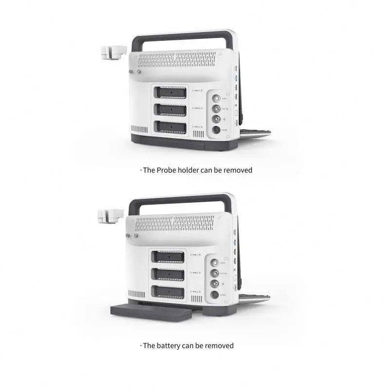 Medical Ultrasonido Diagnostic System 4D Color Doppler Ultrasound Machine with Three Probe Interface — image 6