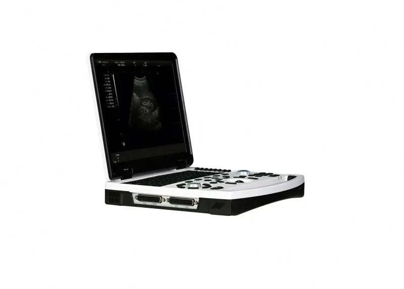 12.1" Portable B/W Ultrasound Machine with 5 Display Modes Medical Diagnostic Scanner for human use — image 2
