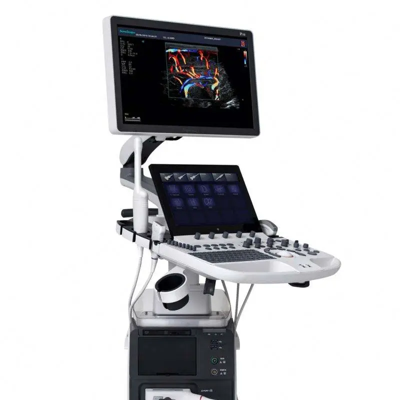 Sonoscape P50 Elite 4D 5D Medical Ultrasound Scanner for Obstetrics Gynecology Cardiovascular Urology — view 1