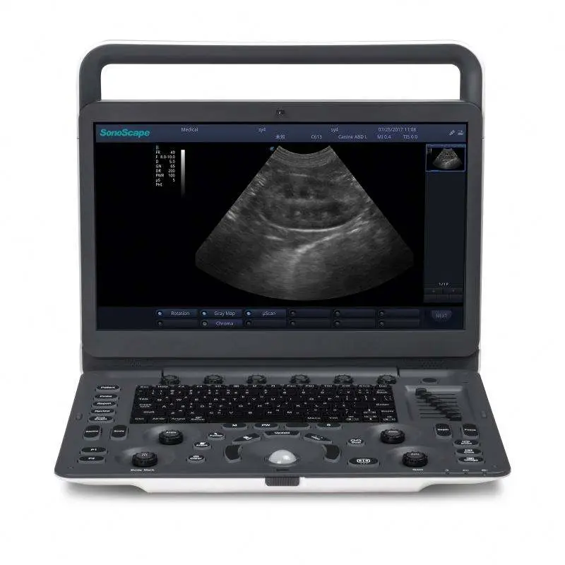 Sonoscape E1 Vet Ultrasound Scanner E1v Animal Pregnancy Ultrasound Machine Veterinary Equipment for Horse Cow — image 2