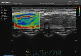 Sonoscape P50 Elite 4D 5D Medical Ultrasound Scanner for Obstetrics Gynecology Cardiovascular Urology — image 7
