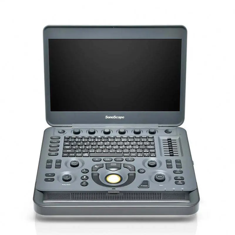 Sonoscape Digital Color Doppler Ultrasound X5 Ultrasound Machine — view 1