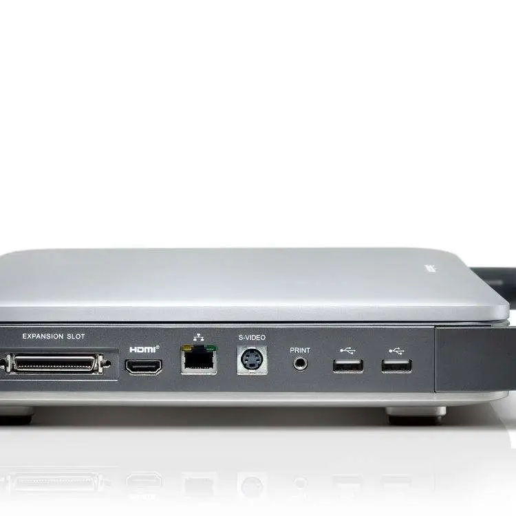Sonoscape Digital Color Doppler Ultrasound X5 Ultrasound Machine — image 5