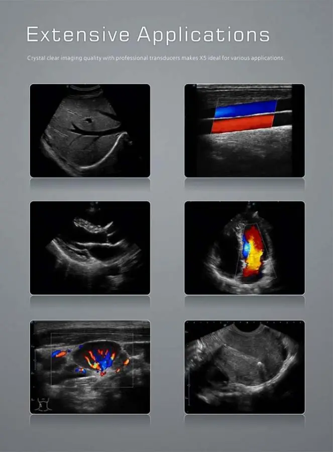 Sonoscape Digital Color Doppler Ultrasound X5 Ultrasound Machine — image 7