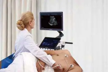 Sonoscape P50 Elite Sonography Ultrasound Echo Machine Hospital Medical Ultrasound Instruments — view 4