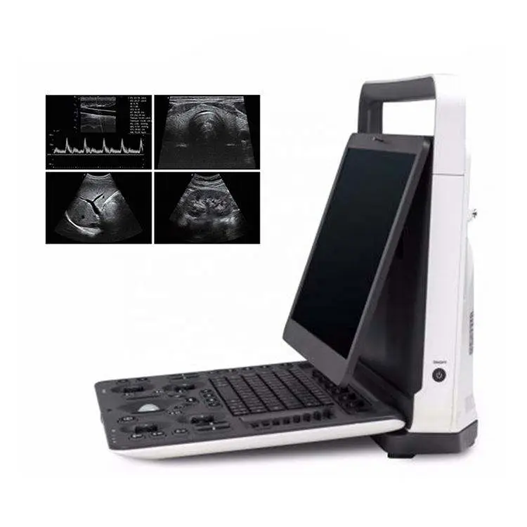 SonoScape E2 Color Doppler Echo Machine Ultrasound Machine USG with TDI CW PW Function — image 3