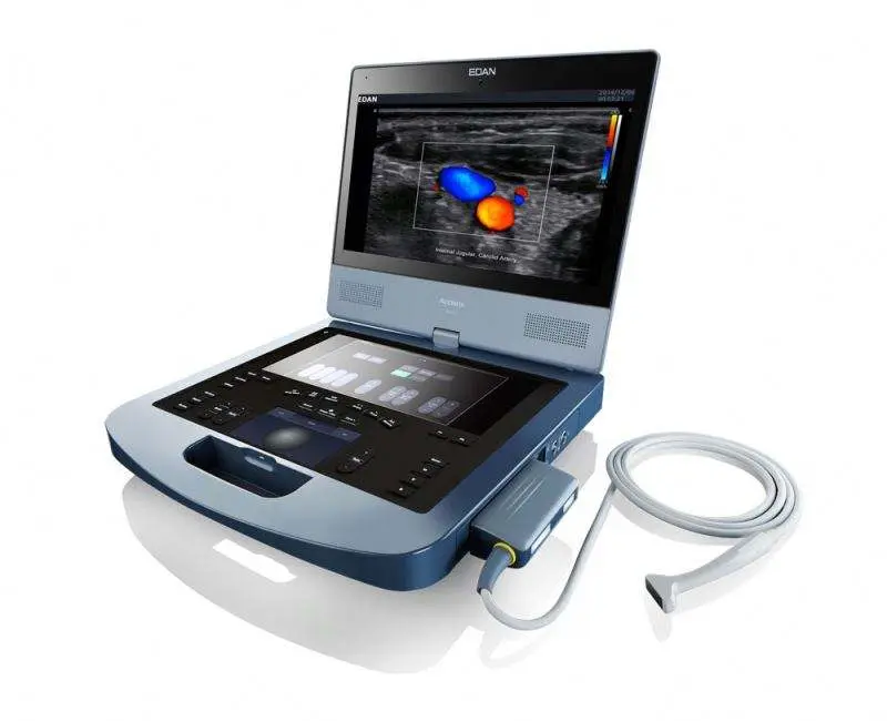 Edan Acclarix Ax3 Ax8 Echocardiography Ultrasound Machine Price for Obstetrics Gynecology Pediatrics Urology — view 1
