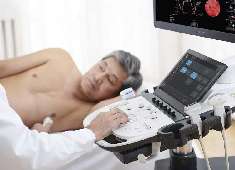 SonoScape P12 Elite Ultrasound Instrument Medical Ultrasonic Diagnosis System Echocardiography Machine Echo Machine Price — image 4