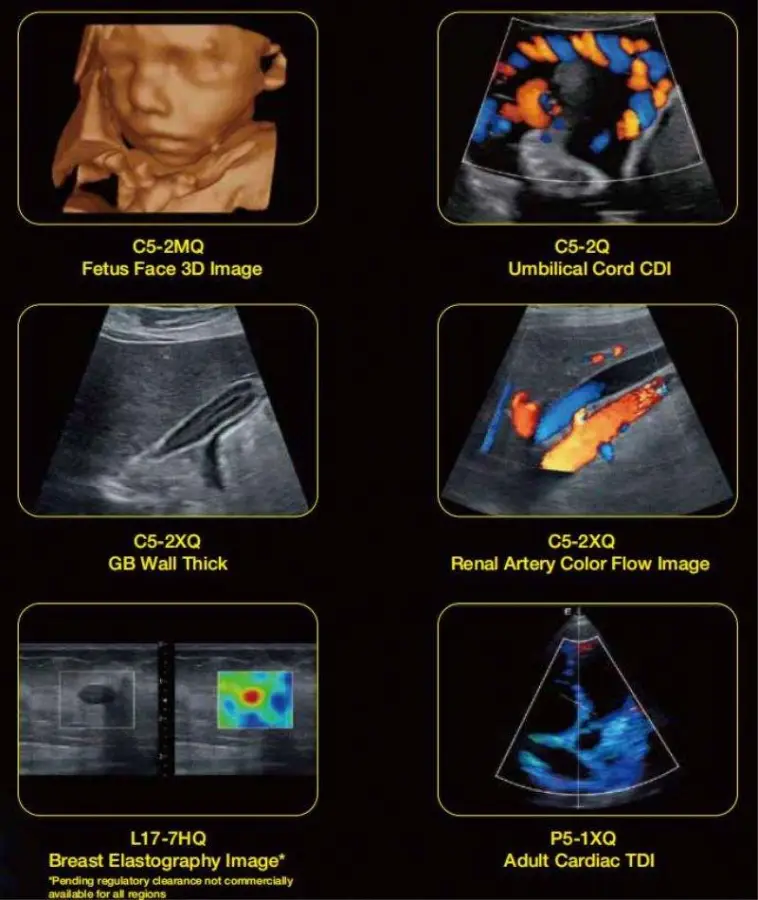 AX8 VET Edan Veterinary Portable Ultrasound Machine Medical Equipment Price for Sale — image 6