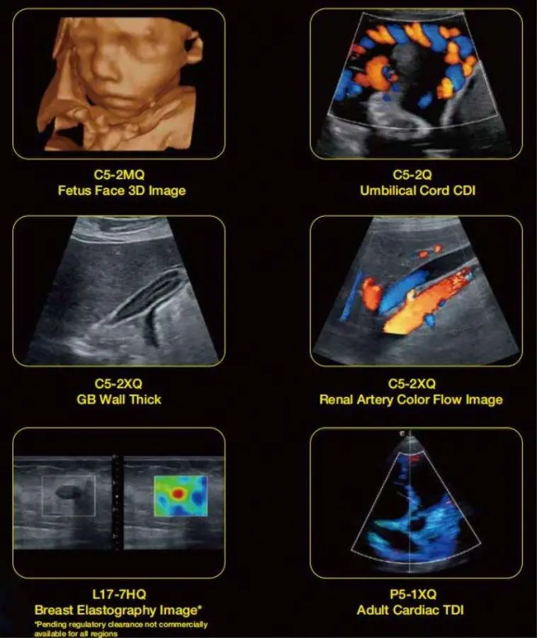 Edan Ax8 Portable Ultrasound Scanner Color Doppler Brand New Ax3/Ax4/Ax8 Price — image 6