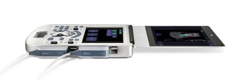 Edan AX3 4D Ultrasound Machine Digital Color Doppler Ultrasonic System — image 4