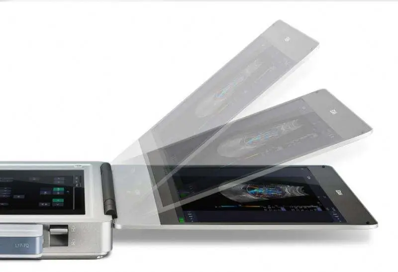 Edan AX3 4D Ultrasound Machine Digital Color Doppler Ultrasonic System — image 5