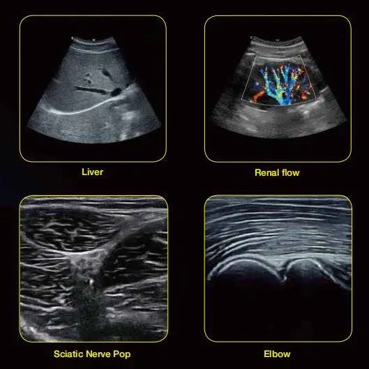 Edan AX3 4D Ultrasound Machine Digital Color Doppler Ultrasonic System — image 6