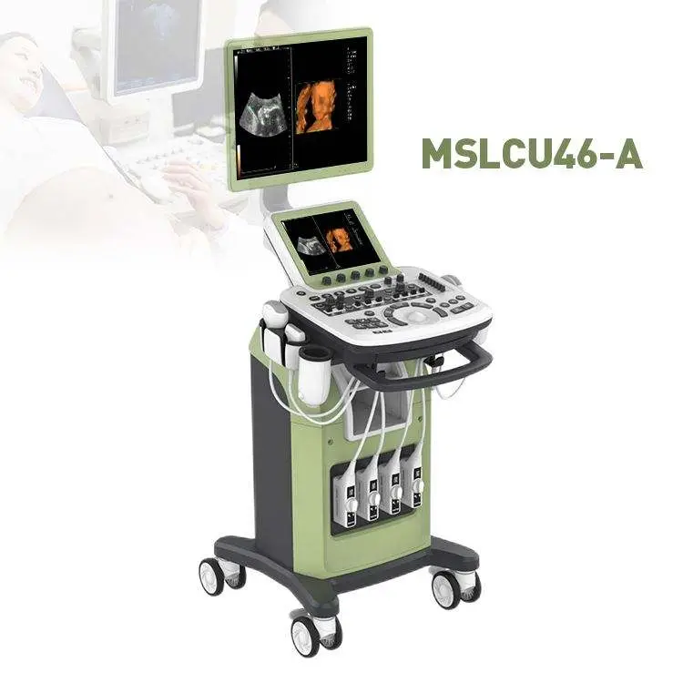 3D/4D Digital Color Doppler System Trolley Ultrasound — image 3