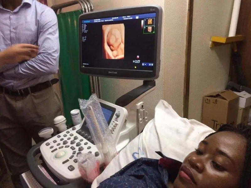 Medical Ultrasound Instruments Sonoscape S22 Sonoscape Ultrasound Machine — image 2