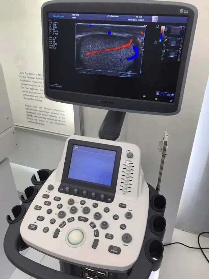 Medical Ultrasound Instruments Sonoscape S22 Sonoscape Ultrasound Machine — image 3