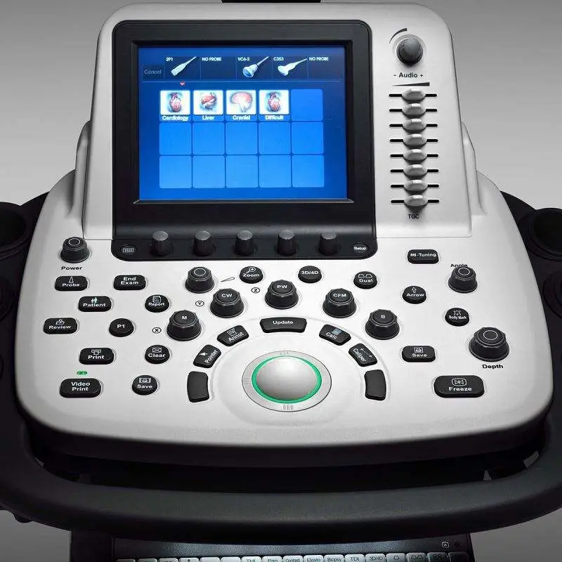 Medical Ultrasound Instruments Sonoscape S22 Sonoscape Ultrasound Machine — image 4