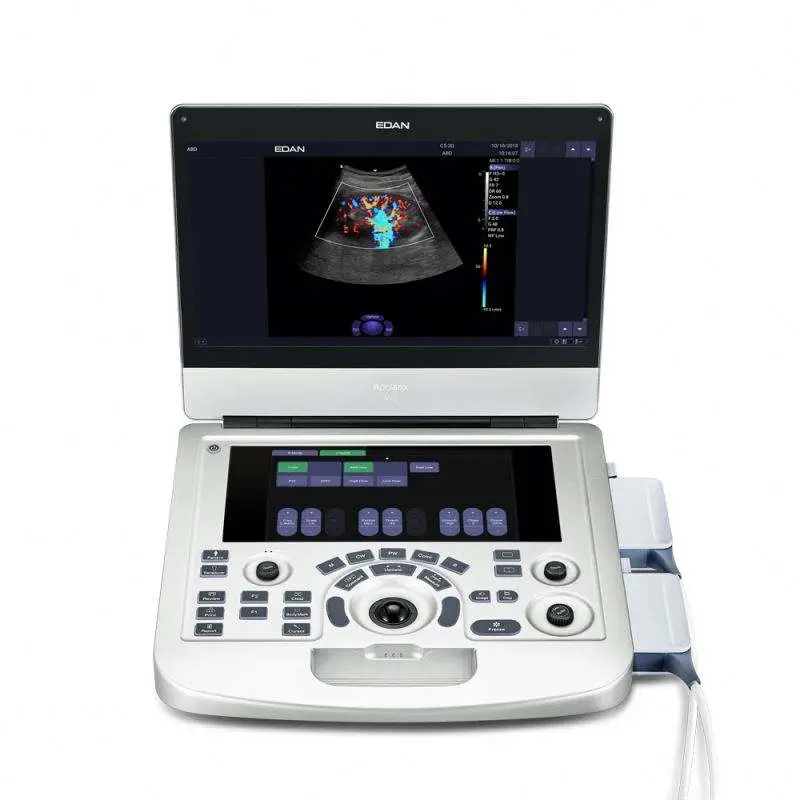 Edan Ax3 Ultrasound Machine Price Medical Ultrasound Scanner for Gynecology Urology Cardiology Acclarix Ax3 — view 1