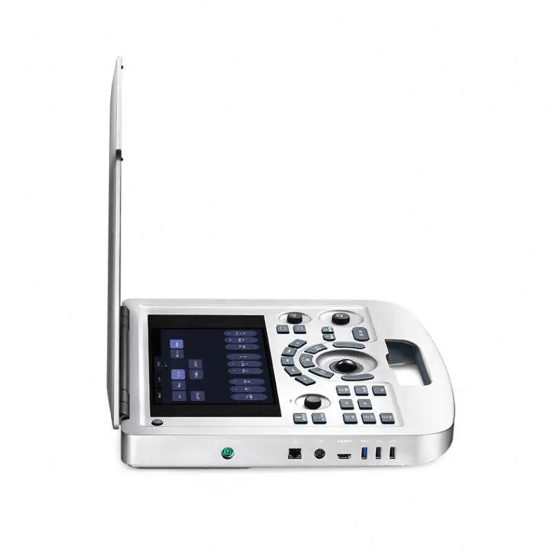 Edan Ax3 Ultrasound Machine Price Medical Ultrasound Scanner for Gynecology Urology Cardiology Acclarix Ax3 — image 2