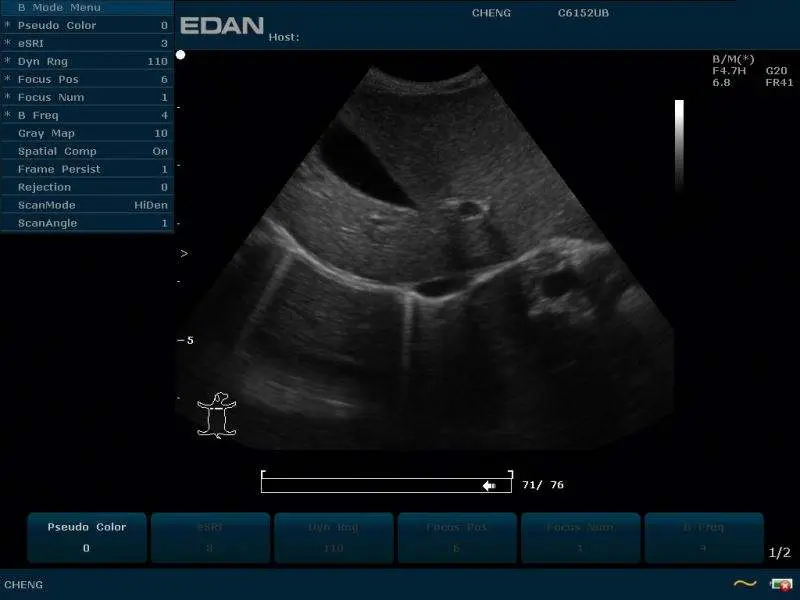 Edan U50 Veterinary Ultrasound Color Doppler Veterinarian Ecografo Veterinary Equipment — view 6