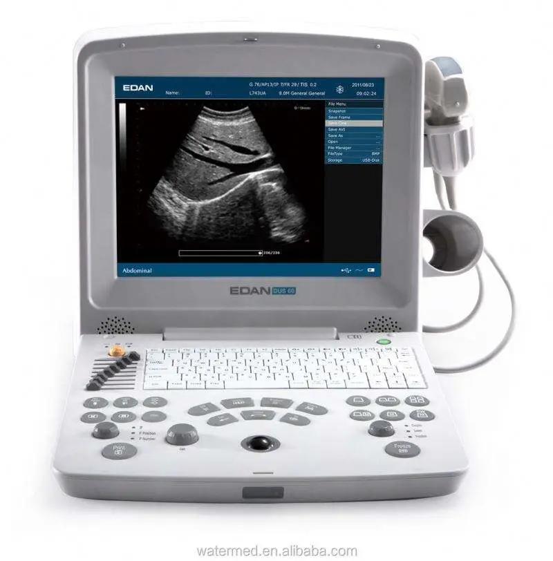 Edan DUS 60 Veterinary Ultrasound Scan Machine — image 3