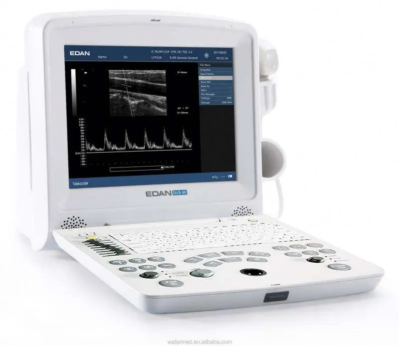 Edan DUS 60 Veterinary Ultrasound Scan Machine — image 4