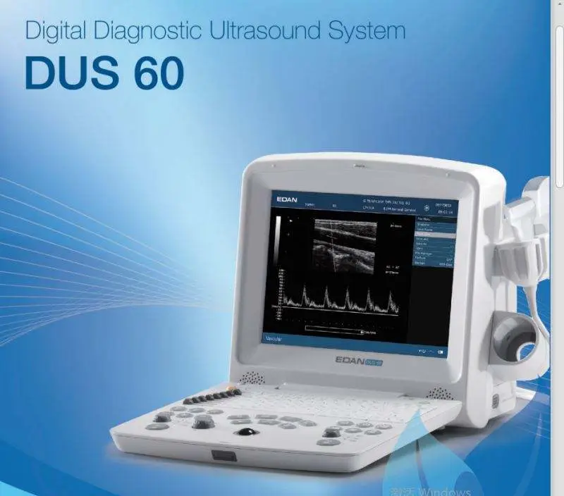 Edan DUS 60 Veterinary Ultrasound Scan Machine — image 5