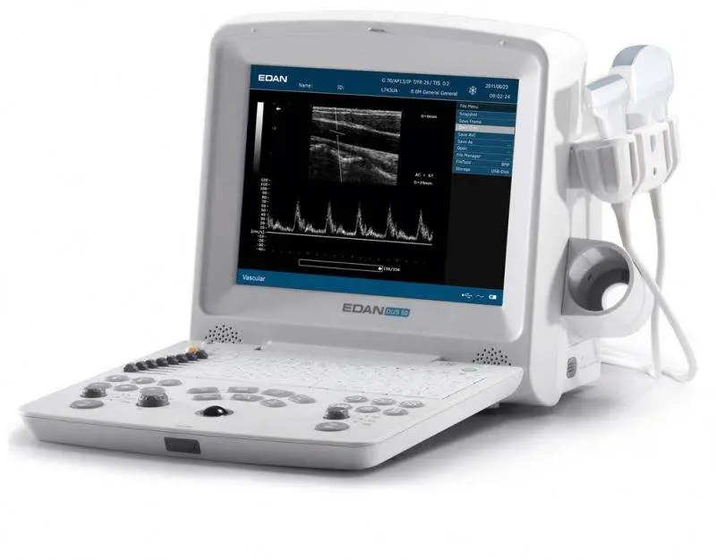 Edan DUS 60 Veterinary Ultrasound Scan Machine — image 6