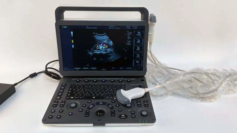 Medical Diagnostic Color Doppler Ultrasonic Ecografo Portatil 3D 4D Portable Ultrasound Machine — image 5