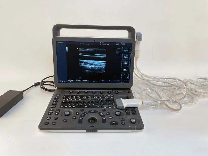 Best Price CW, TDI , PDI Handheld Portable Ultrasonido 3D 4D Veterinary Doppler Ultrasound Machine — image 5