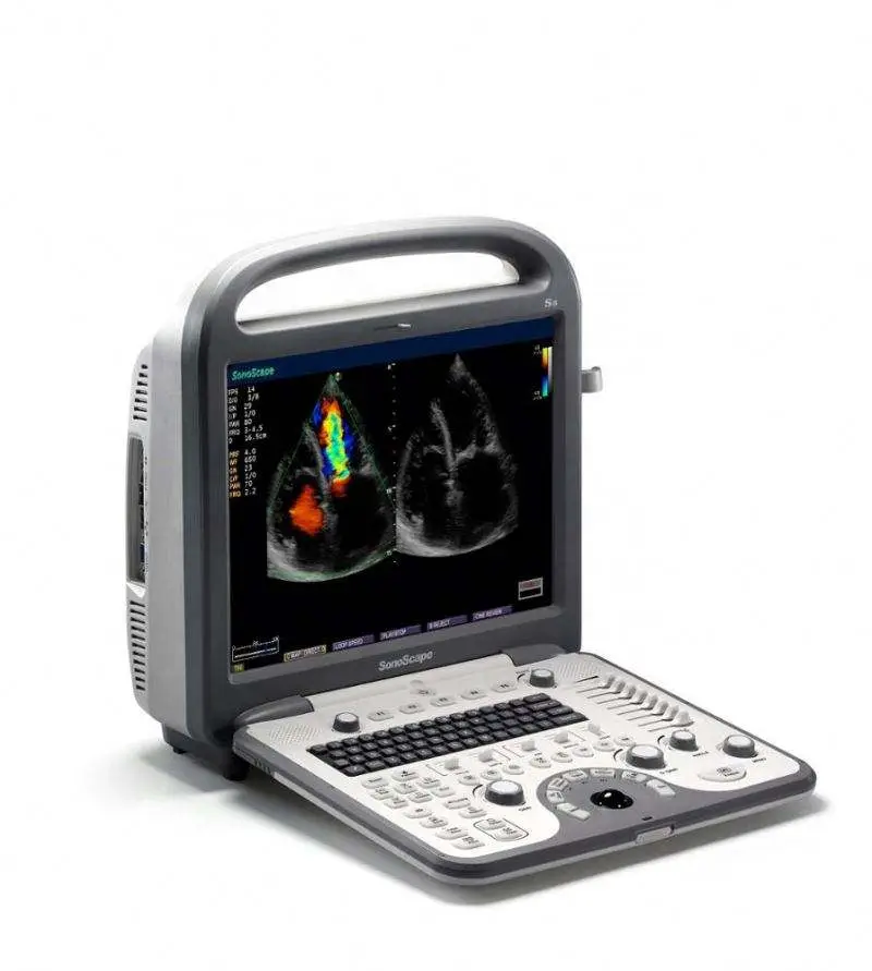 Sonoscape Ultrasound Machine SonoScape S8 — image 3