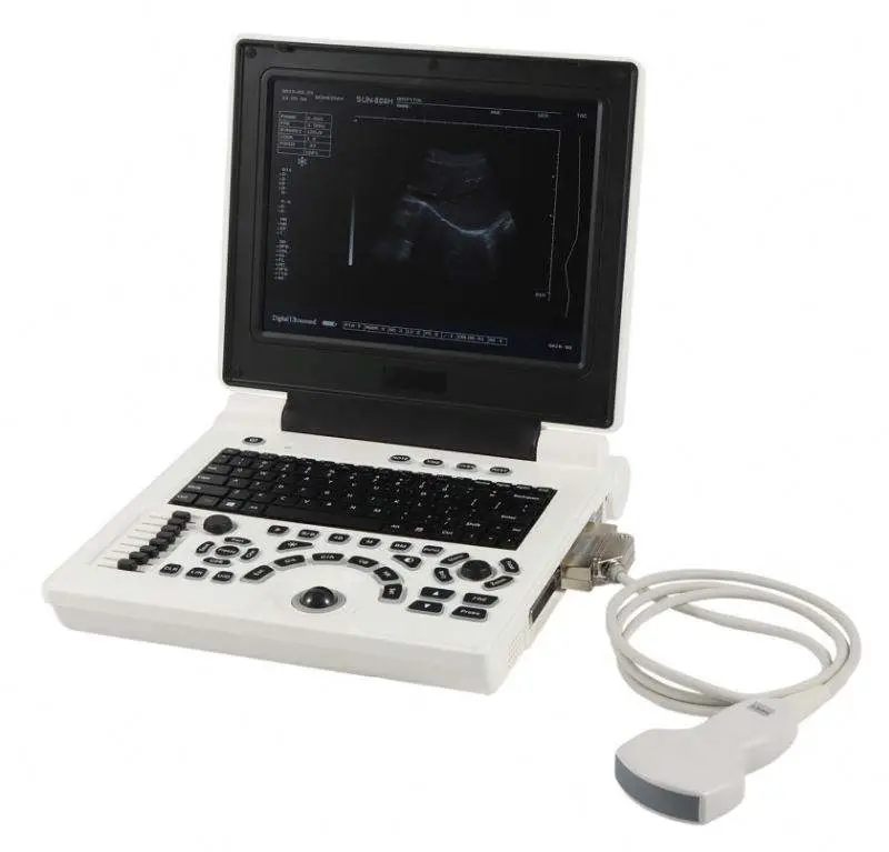 Black&white Portable Medical Ultrasound Scanner Machine for Vet Use — image 2