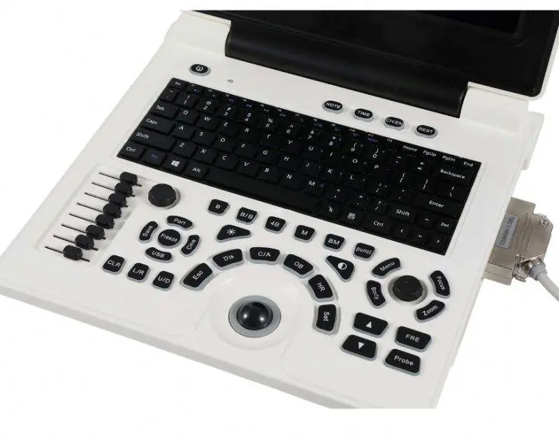 Black&white Portable Medical Ultrasound Scanner Machine for Vet Use — image 3
